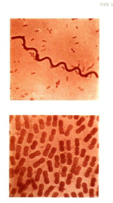 Photography of Bacteria 7
