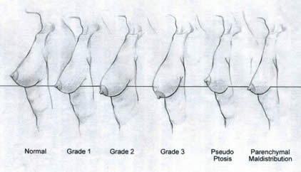 pencil breast test