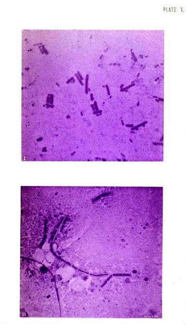 Photography of Bacteria 4