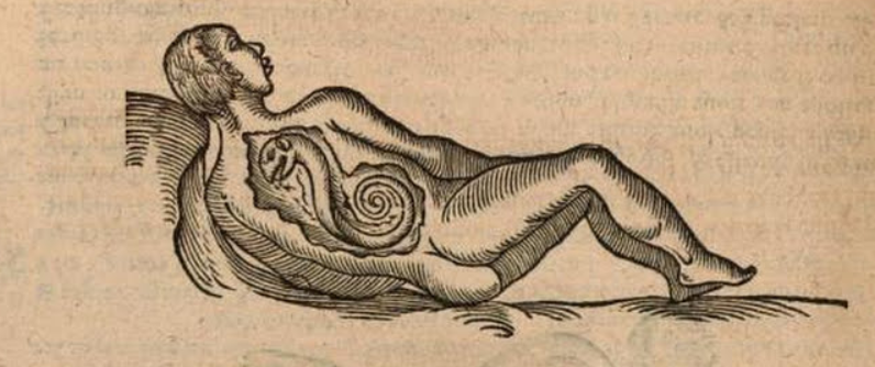 Woodcut from Les oeuvres d’Ambroise Paré showing a woman with a snake-like creature inside her.